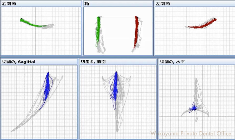 症例①